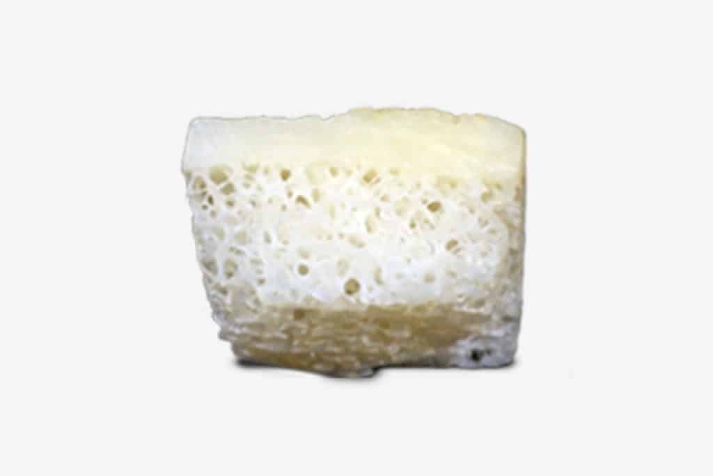 Bloco Córtico Esponjoso de Metáfise